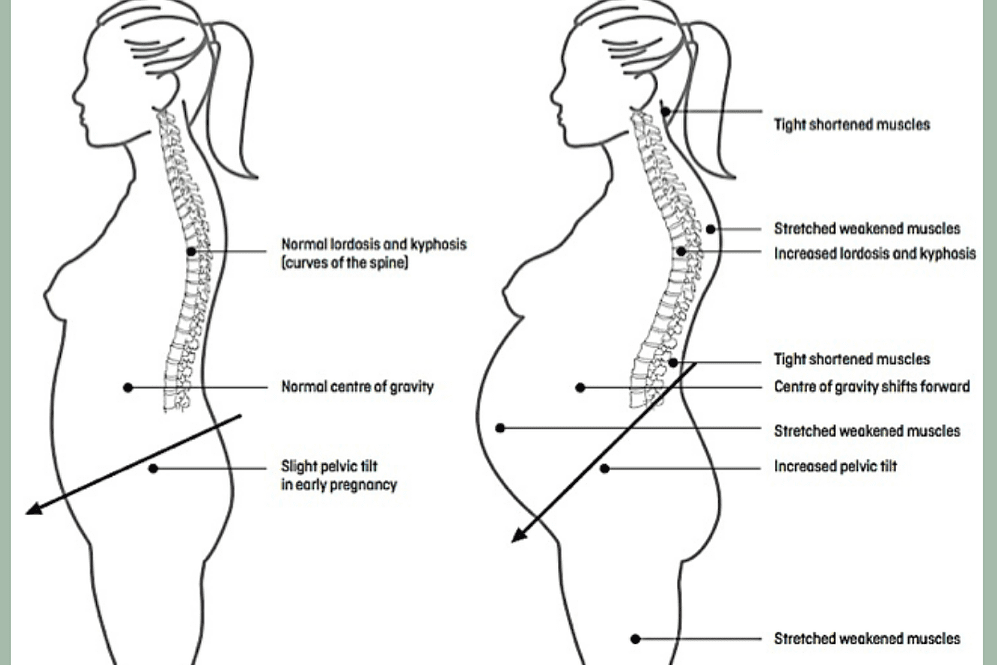 labelled example of posture changes during pregnancy